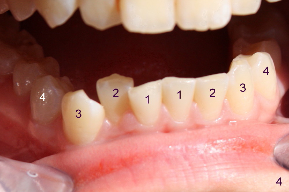 Dental Education Lecture